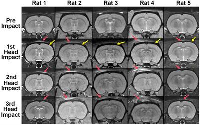 Quantitative Imaging of Blood-Brain Barrier Permeability Following Repetitive Mild Head Impacts